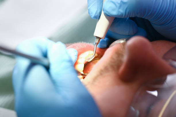 Best Tooth Infection Emergency Dentist  in West Ishpeng, MI